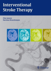 Interventional Stroke Therapy