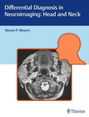 Differential Diagnosis in Neuroimaging - Head and Neck