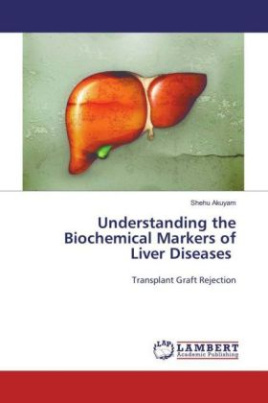 Understanding the Biochemical Markers of Liver Diseases