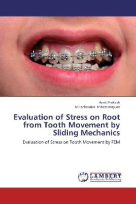 Evaluation of Stress on Root from Tooth Movement by Sliding Mechanics