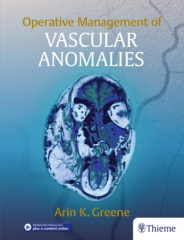Operative Management of Vascular Anomalies, m. 1 Buch, m. 1 E-Book