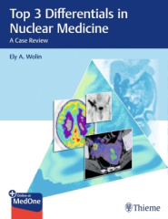 Top 3 Differentials in Nuclear Medicine